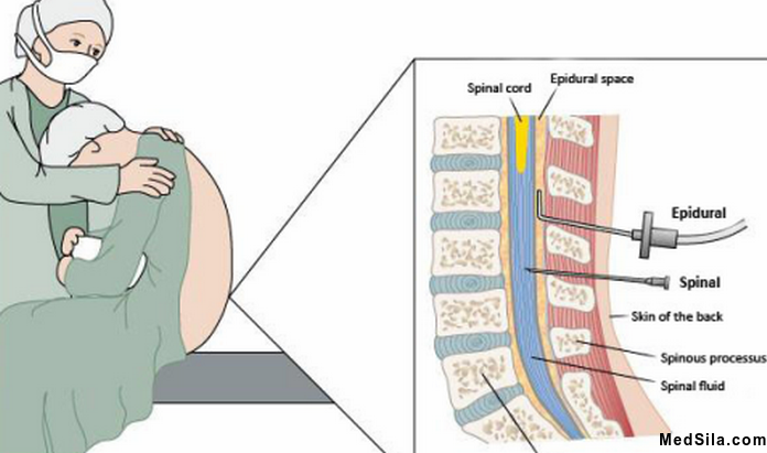 Анатомические основы спинальной анестезии